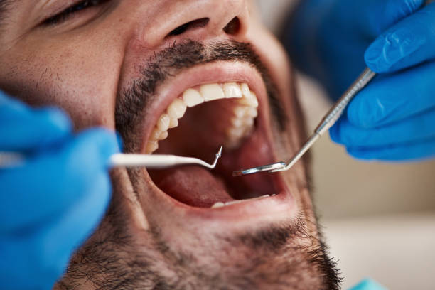 Best Emergency Dental Extractions in Smithville, OH